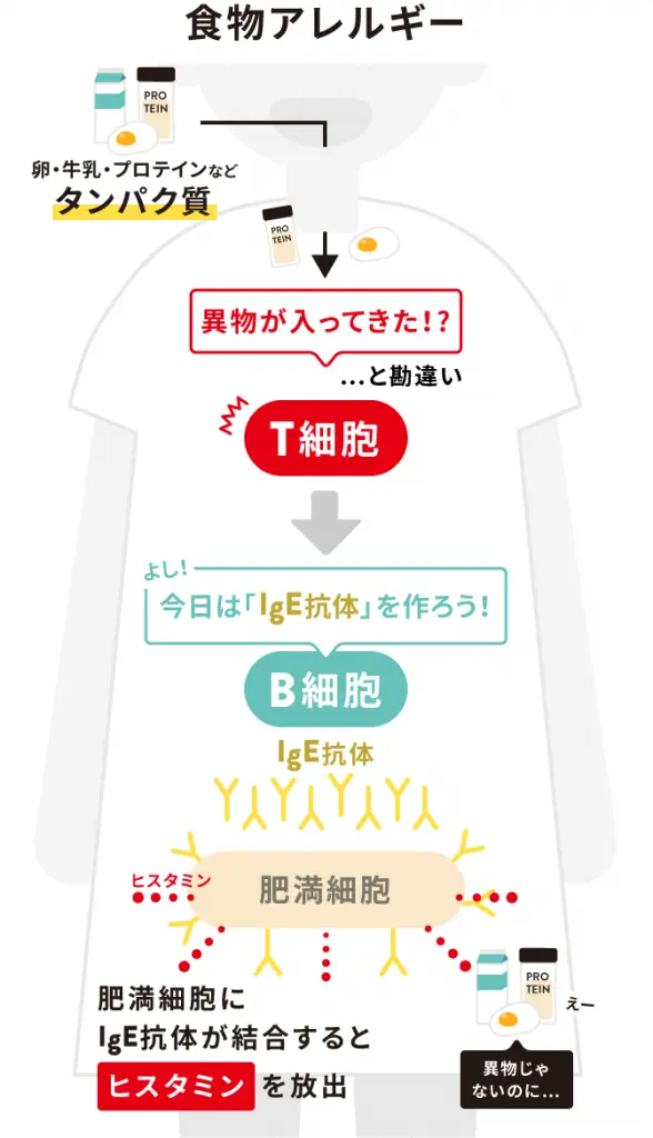 食物アレルギーの場合